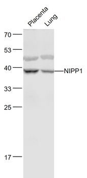 NIPP1 Rabbit Polyclonal Antibody