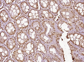 Phospho-NFKB p65 (Thr254) Rabbit Polyclonal Antibody