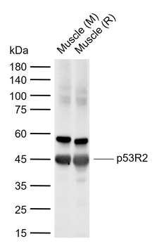 P53R2 Rabbit Polyclonal Antibody