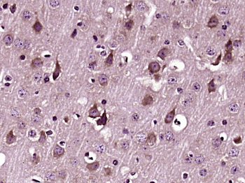 Notch 2 Rabbit Polyclonal Antibody