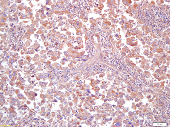 MT-ND5 Rabbit Polyclonal Antibody