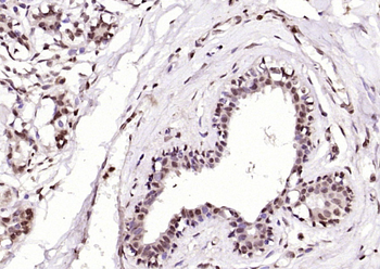 NUMA1 Rabbit Polyclonal Antibody
