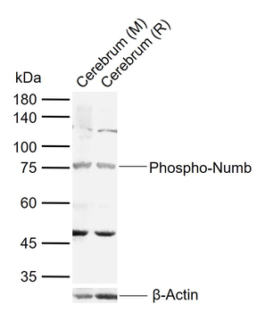 Phospho-Numb (Ser276) Rabbit Polyclonal Antibody
