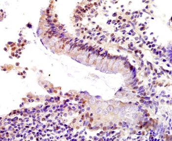 P53BP1 Rabbit Polyclonal Antibody