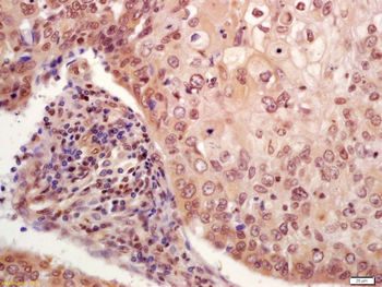 Phospho-P53 (Ser33) Rabbit Polyclonal Antibody
