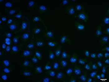 Phospho-RPS6KB1 (Ser417) Rabbit Polyclonal Antibody