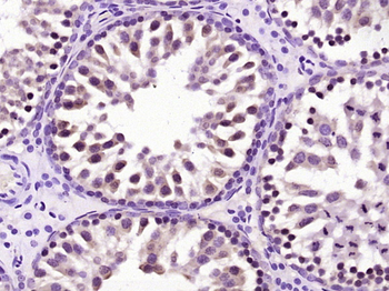 PABP (Methyl Arg455/460) Rabbit Polyclonal Antibody