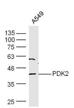 PDK2 Rabbit Polyclonal Antibody