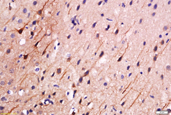 Phospho-PEA15 (Ser116) Rabbit Polyclonal Antibody
