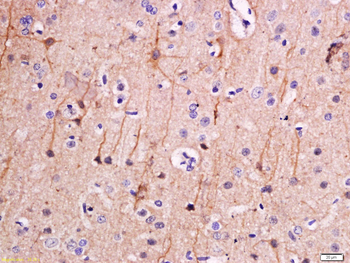 Phospho-PEA15 (Ser116) Rabbit Polyclonal Antibody