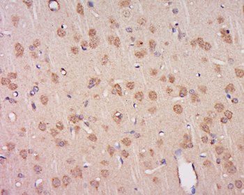 PFKFB2/PFK2 Rabbit Polyclonal Antibody