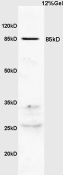 PIK3R2 Rabbit Polyclonal Antibody