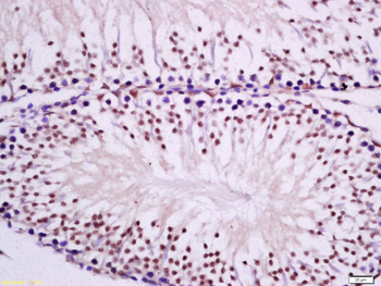PKC epsilon Rabbit Polyclonal Antibody