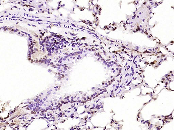 Phospho-PKC delta (Tyr311) Rabbit Polyclonal Antibody