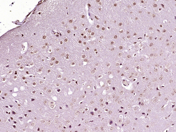 PITX3 Rabbit Polyclonal Antibody