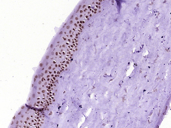 PITX3 Rabbit Polyclonal Antibody