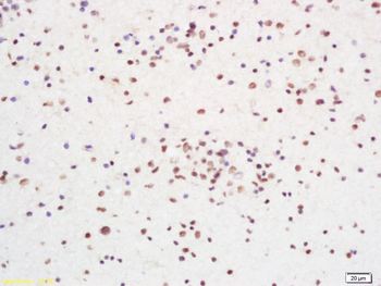 RCC1 Rabbit Polyclonal Antibody