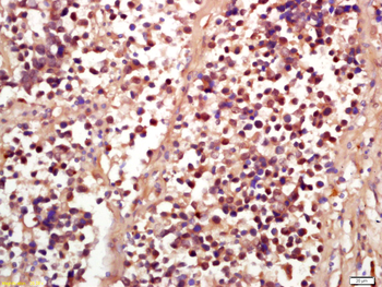 Phospho-RSK2 (Ser227) Rabbit Polyclonal Antibody