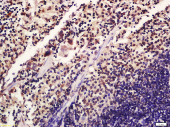 Phospho-SATB1 (Ser47) Rabbit Polyclonal Antibody