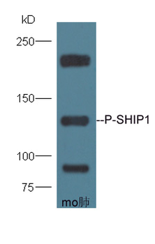 Phospho-SHIP1 (Tyr1020) Rabbit Polyclonal Antibody