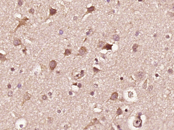 Phospho-INPPL1 (Tyr1135) Rabbit Polyclonal Antibody