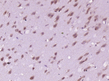Phospho-INPPL1 (Tyr1135) Rabbit Polyclonal Antibody