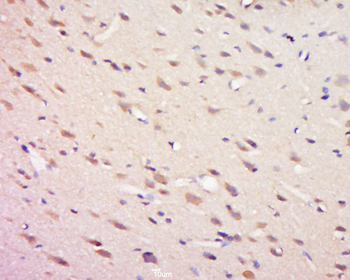 Phospho-PTPN11 (Tyr81) Rabbit Polyclonal Antibody