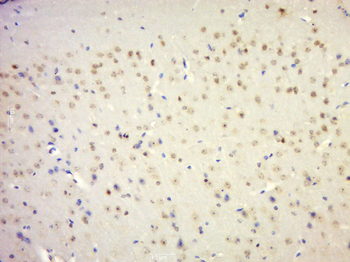 Phospho-Smad2 (Ser245 + Ser250 + Ser255) Rabbit Polyclonal Antibody