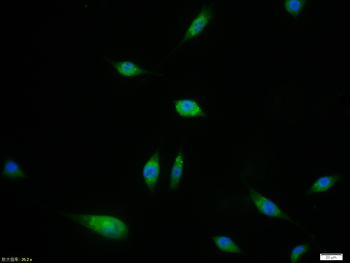 SPHK2 Rabbit Polyclonal Antibody