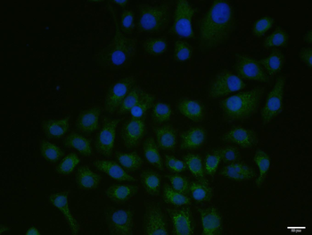 Phospho-Src (Tyr215) Rabbit Polyclonal Antibody