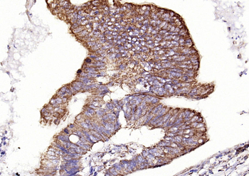 CD9 Recombinant Rabbit Monoclonal Antibody