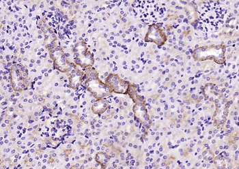 CD9 Recombinant Rabbit Monoclonal Antibody