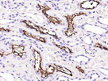 ACE2 Recombinant Rabbit Monoclonal Antibody