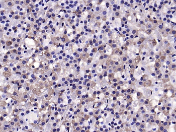 HSL/LIPE Rabbit Polyclonal Antibody