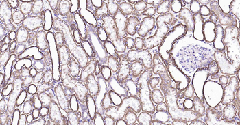 Sodium Potassium ATPase Mouse Monoclonal Antibody