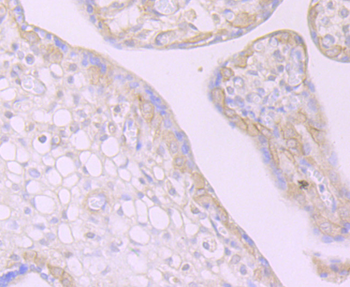 Desmoglein 2 Recombinant Rabbit Monoclonal Antibody