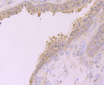 Desmoglein 2 Recombinant Rabbit Monoclonal Antibody