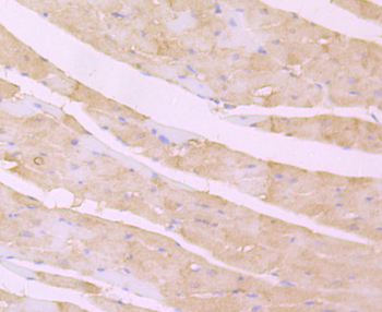 Desmoglein 2 Recombinant Rabbit Monoclonal Antibody
