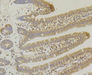 MARK3 Recombinant Rabbit Monoclonal Antibody