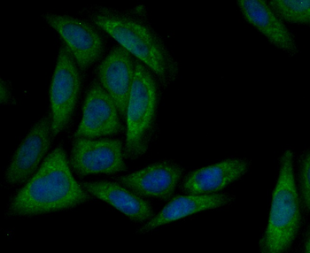 MARK3 Recombinant Rabbit Monoclonal Antibody