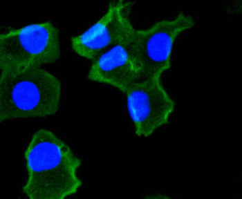 NADPH oxidase 4 Recombinant Rabbit Monoclonal Antibody