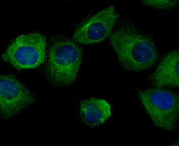 ARP3 Recombinant Rabbit Monoclonal Antibody