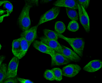 ARP3 Recombinant Rabbit Monoclonal Antibody