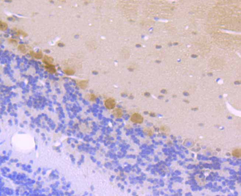 CSNK2B/CK II beta Recombinant Rabbit Monoclonal Antibody