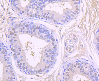 CSNK2B/CK II beta Recombinant Rabbit Monoclonal Antibody