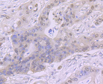 CSNK2B/CK II beta Recombinant Rabbit Monoclonal Antibody