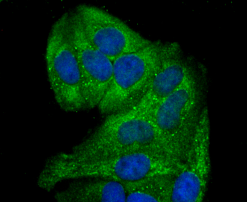 GCLM Recombinant Rabbit Monoclonal Antibody
