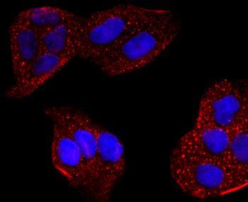 CYP2E1 Recombinant Rabbit Monoclonal Antibody