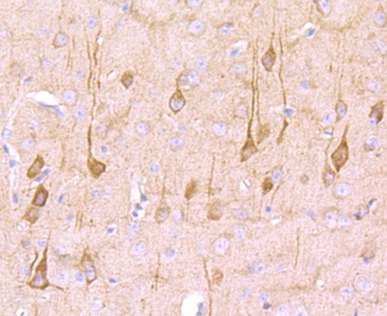 NG2 Recombinant Rabbit Monoclonal Antibody