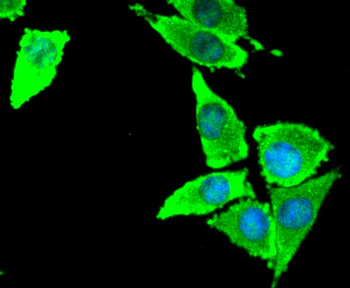 Tissue factor Recombinant Rabbit Monoclonal Antibody